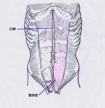 腹直筋